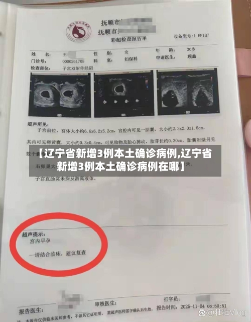 【辽宁省新增3例本土确诊病例,辽宁省新增3例本土确诊病例在哪】