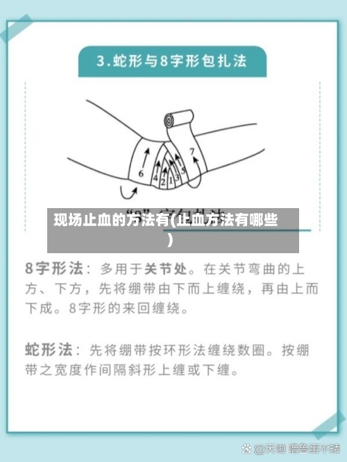 现场止血的方法有(止血方法有哪些)-第2张图片