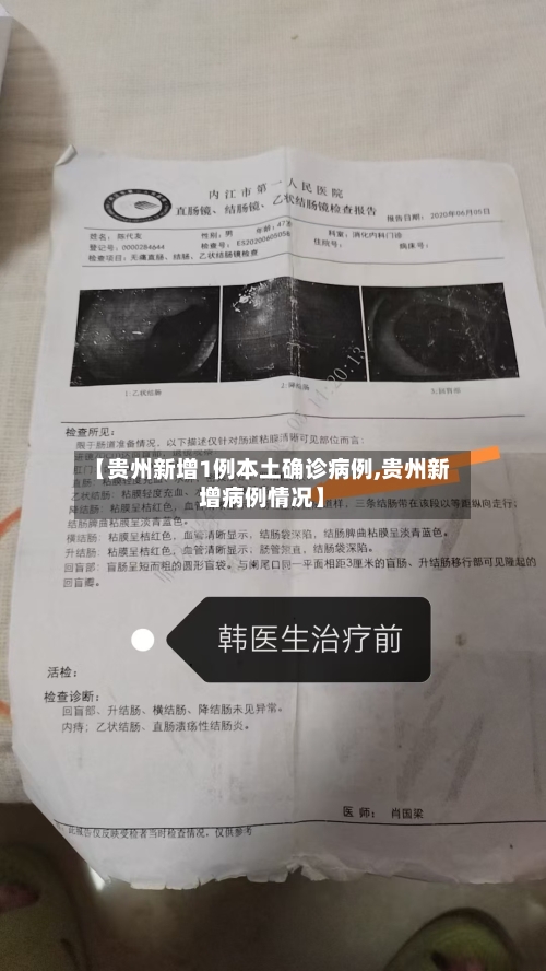 【贵州新增1例本土确诊病例,贵州新增病例情况】-第3张图片