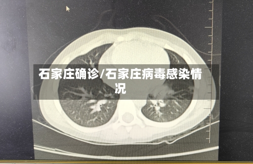石家庄确诊/石家庄病毒感染情况-第1张图片