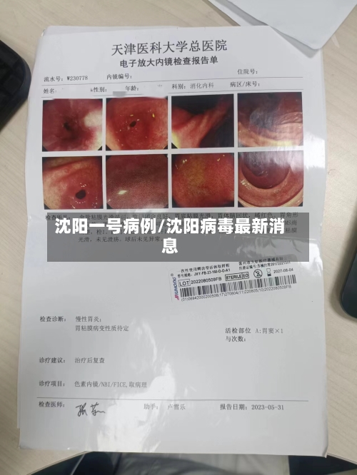 沈阳一号病例/沈阳病毒最新消息