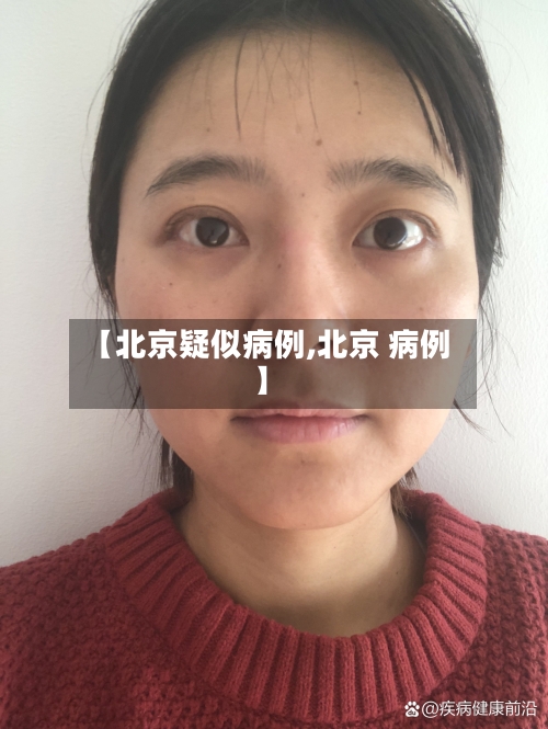 【北京疑似病例,北京 病例】-第2张图片