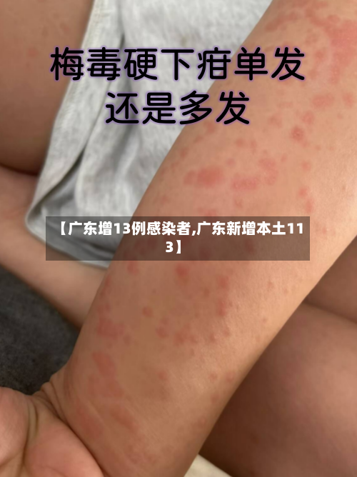 【广东增13例感染者,广东新增本土11 3】-第2张图片